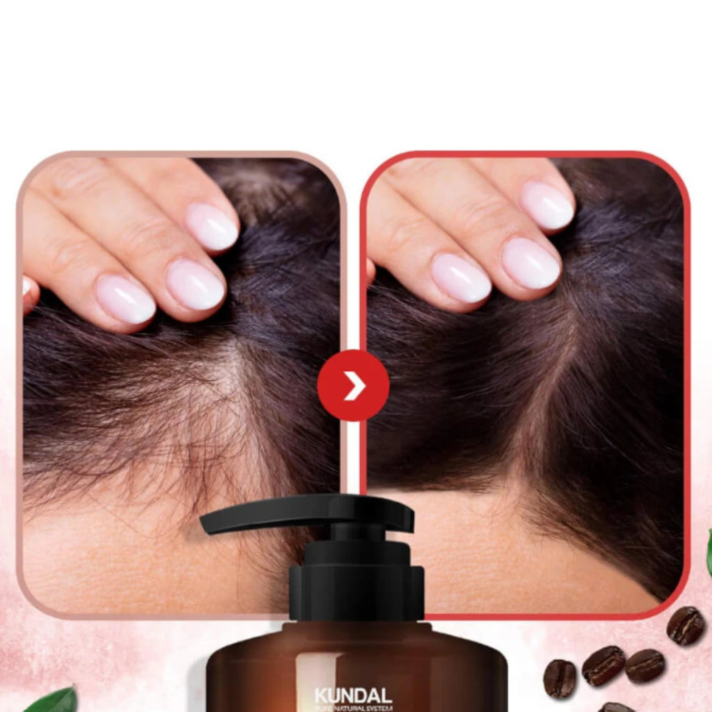 Kundal- Shampoo Anticaida Caffeina