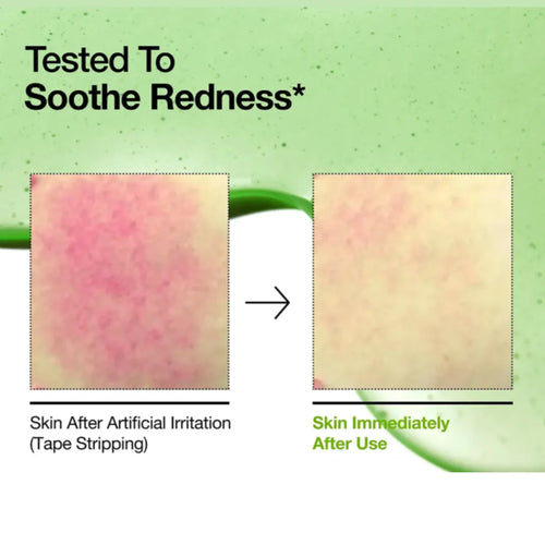 Anua Azelaic Acid 10 Hyaluron Redness Soothing Serum